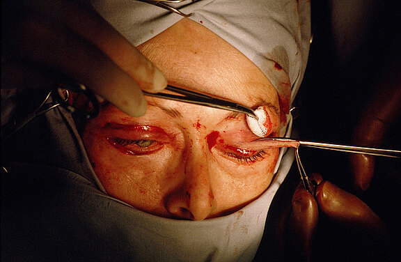 Schoenheitschirugie.jpg  